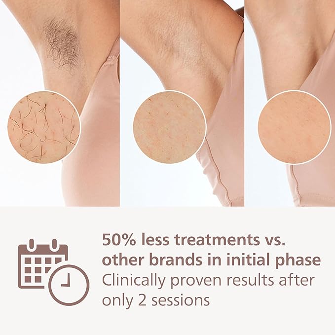 Philips Lumea 9000 IPL Hair Removal – At-Home Laser Alternative with SenseIQ, 4 Attachments for Body & Face, Cordless & Corded (BRI957/00)